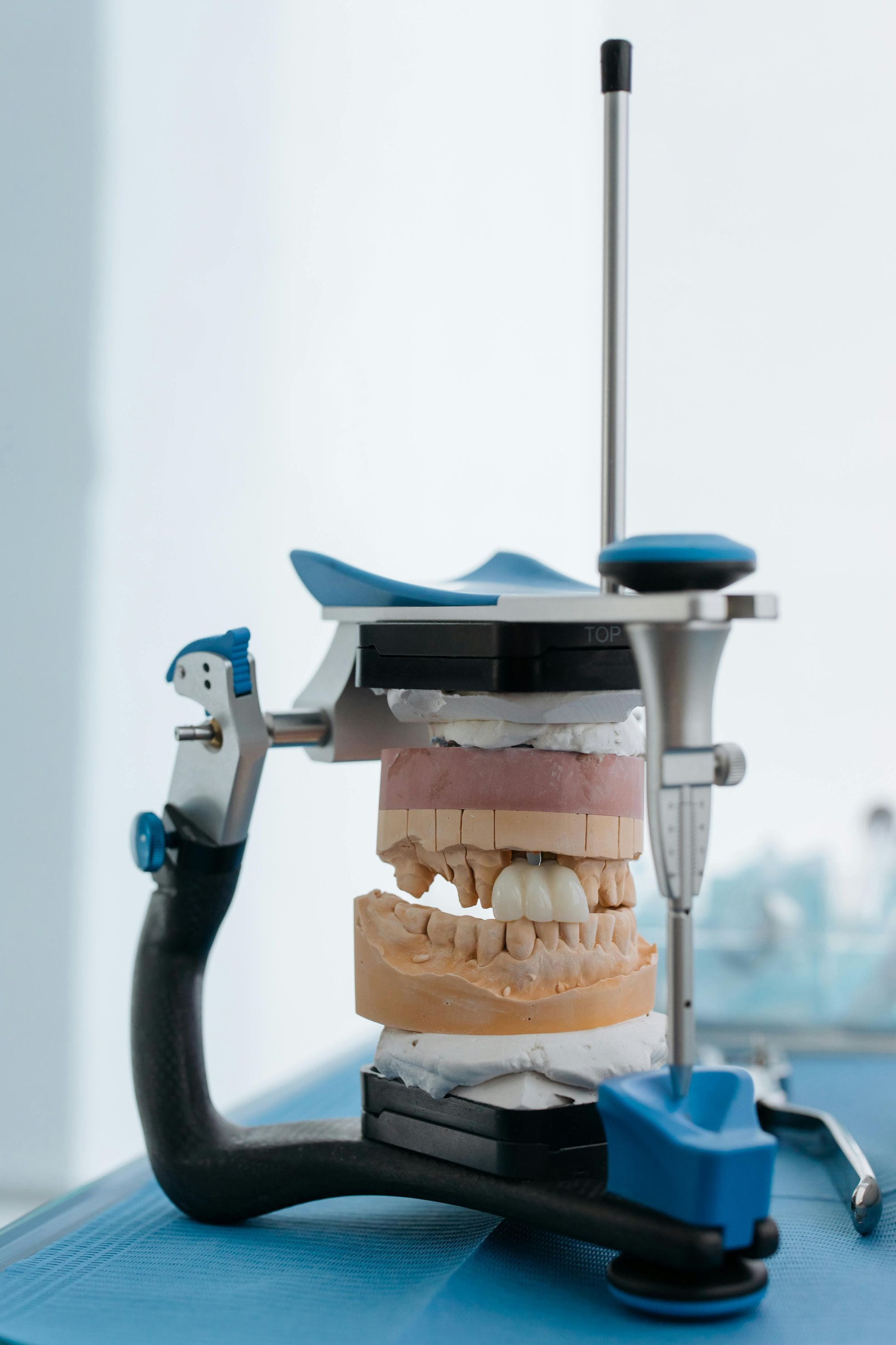 Tipos de articuladores dentales que necesitas en tu consultorio